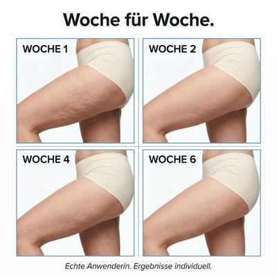 Woche fuer Woche - Hautbildveraenderung Tag 1 bis Tag 42