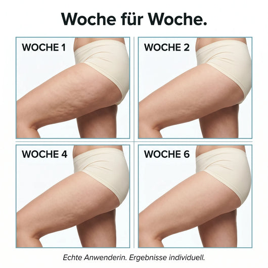 Woche fuer Woche - Hautbildveraenderung Tag 1 bis Tag 42