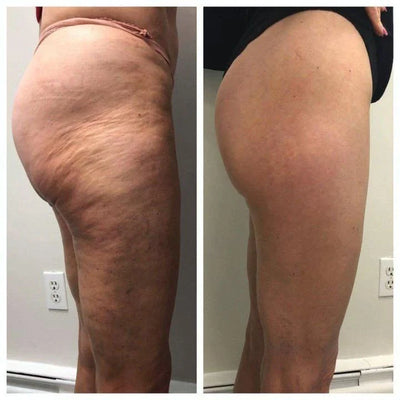 Mildara Onda™ · Der Modellier-Roller